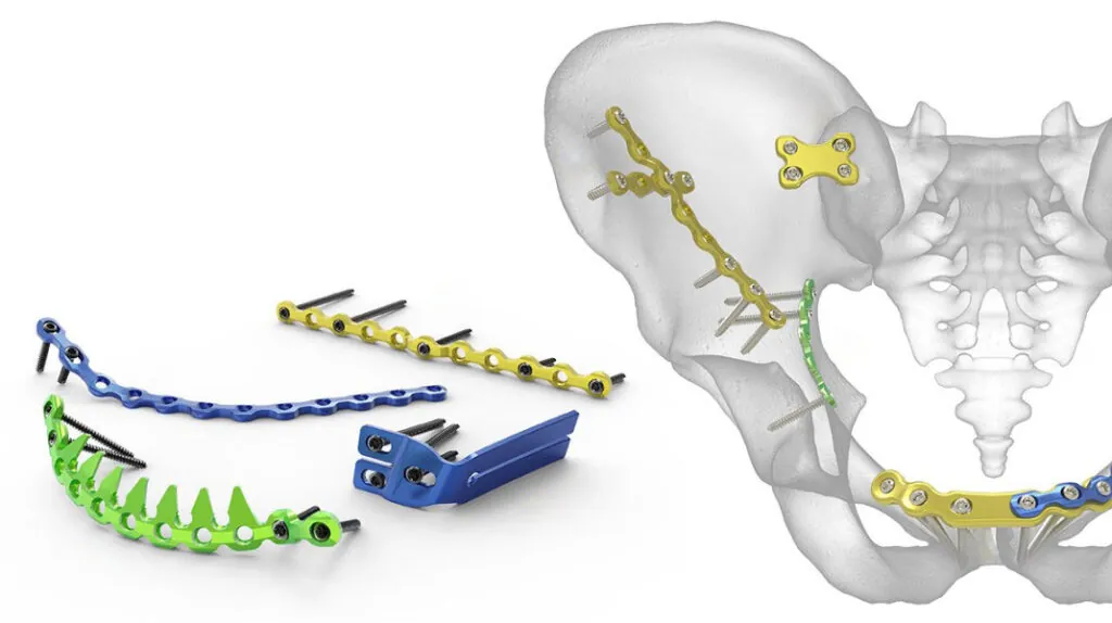 Pelvic Plating System Orthopaedic Solutions Fixation Products – Care ...